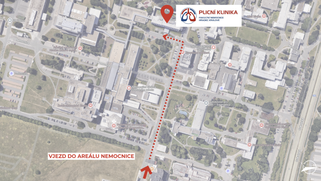 Mapka: cesta do postcovidové ambunace ve Fakultní nemocnic Hradec Králové